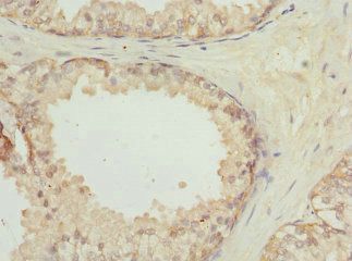 LGALS8 Antibody