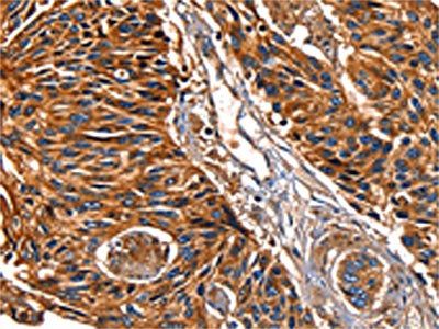 LGALS8 Antibody