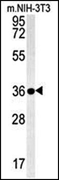 LGALS9B antibody