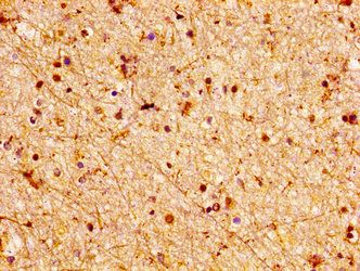 LGI2 Antibody