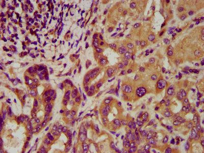 LGI4 Antibody