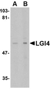 LGI4 Rabbit Polyclonal Antibody