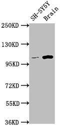 LGR5 Recombinant Monoclonal Antibody