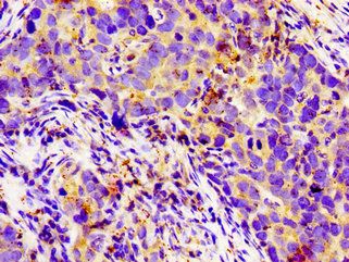 LGR6 Antibody
