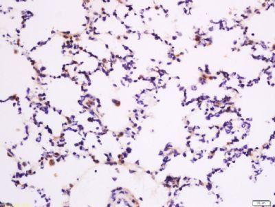 LGR6 Rabbit Polyclonal Antibody