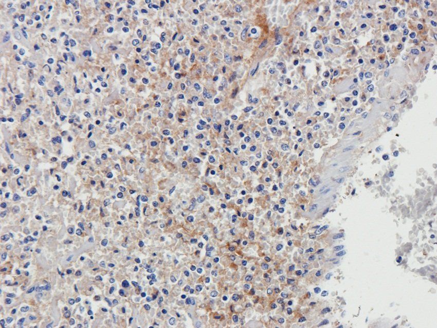 LGR7 antibody