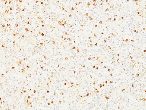 LHB Antibody
