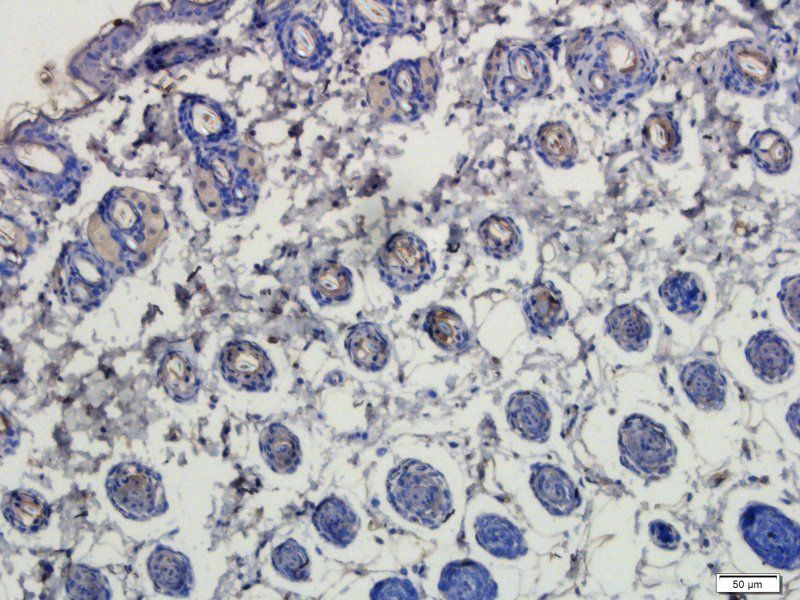 LHCGR antibody