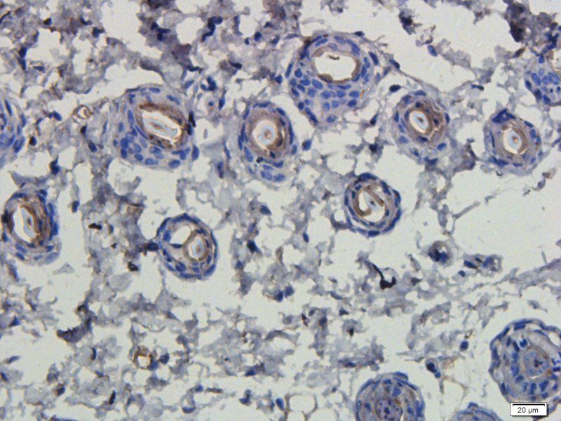 LHCGR antibody