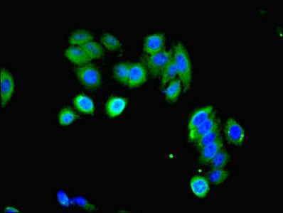 LHCGR Antibody
