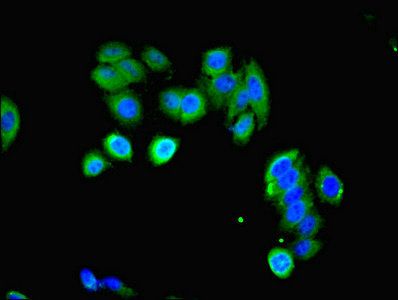 LHCGR antibody