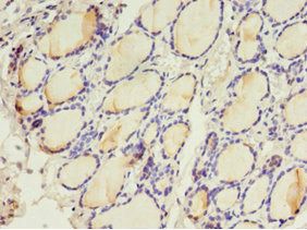 LHCGR Antibody