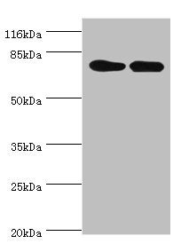 LHCGR Antibody