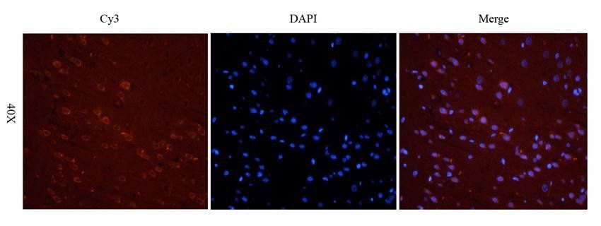 LHCGR antibody