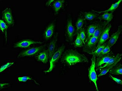 LHFPL1 antibody