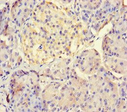 LHFPL1 Antibody