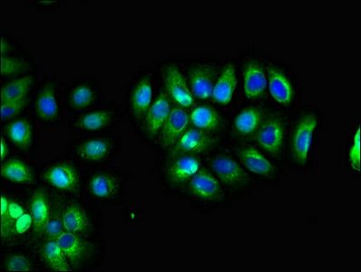 LHFPL5 Antibody