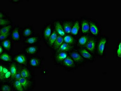 LHFPL5 antibody