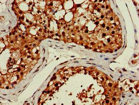 LHFPL5 Antibody