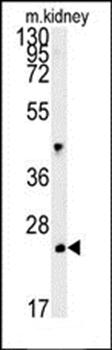 LHPL3 antibody