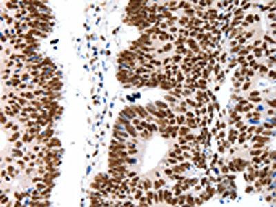 LIFR antibody