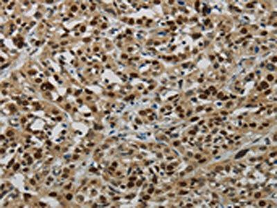 LIG1 Antibody