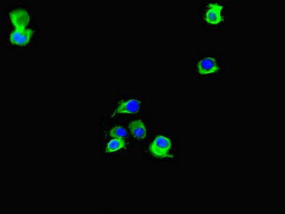 LIG3 antibody