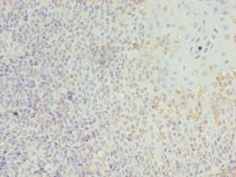 LILRA2 Antibody