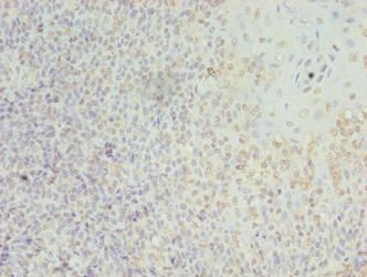 LILRA2 antibody