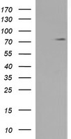 LIM Kinase 1 Antibody