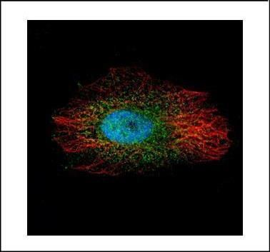 LIM kinase 2 Rabbit Polyclonal Antibody