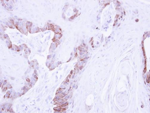LIM kinase 2 Rabbit Polyclonal Antibody