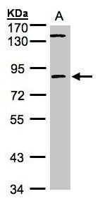 LIM kinase 2 Rabbit Polyclonal Antibody