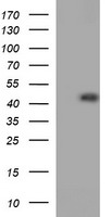 LHX1 Antibody