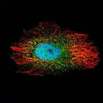 LIM kinase 2 antibody