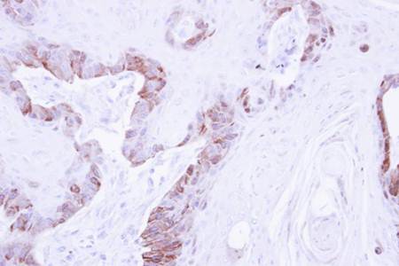 LIM kinase 2 antibody