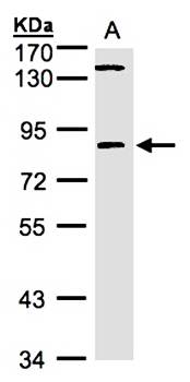 LIM kinase 2 antibody