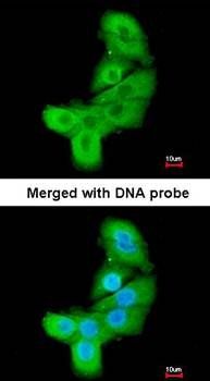 LIM kinase 2 antibody