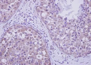 LIM kinase 2 antibody