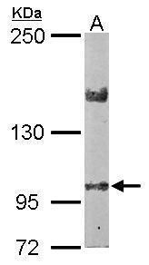 LIMCH1 antibody [C2C3], C-term
