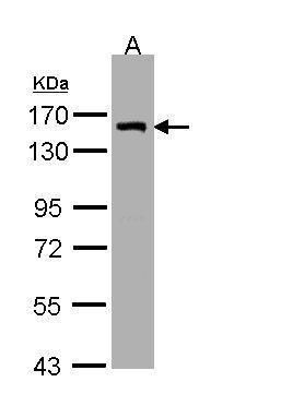 LIMCH1 antibody [C2C3], C-term