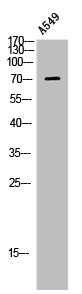 LIMK1 Antibody