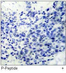 LIMK1 (Phospho-Thr508) Antibody