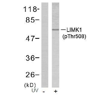 LIMK1 (Phospho-Thr508) Antibody