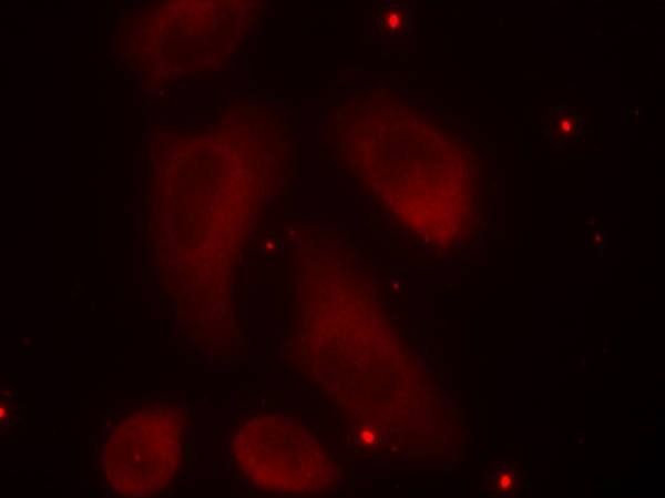 LIMK1 (Phospho-Thr508) Antibody