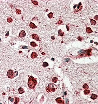 Goat anti-LIMP2 / SCARB2 Antibody