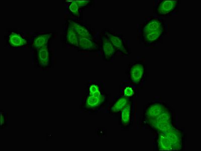 LIN28B antibody