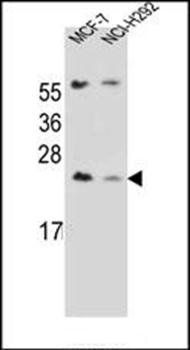 LIN7C antibody
