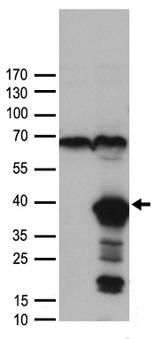 FLJ33360 Antibody