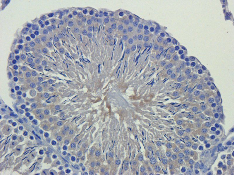 LIPG antibody